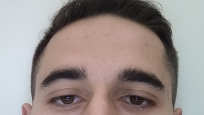 Alnım ve vücudumda yağlı sivilceler çıkıyor, ne yapmam gerekiyor?