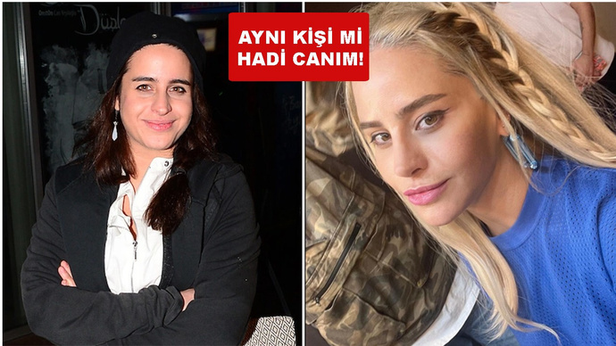 Herkesin beğenisini kazanmak uğruna estetik yaptırır mıydınız?