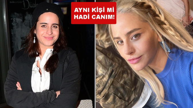 Herkesin beğenisini kazanmak uğruna estetik yaptırır mıydınız?