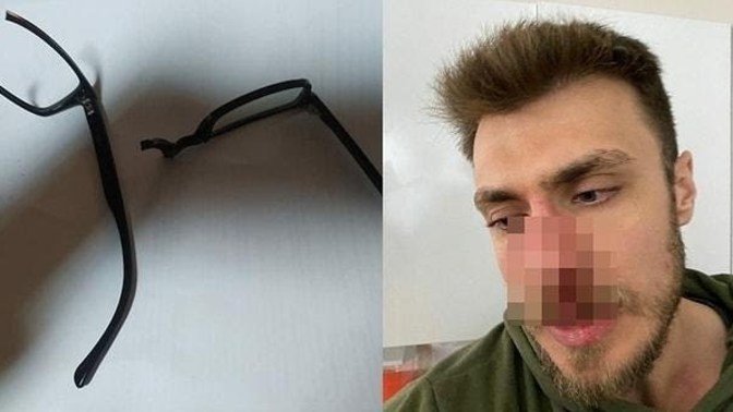 İzmir'de hamile eşini hastaneye götüren Suriyeli Benim karıma erkek doktor bakamaz diyerek doktora saldırıp doktorun burnunu kırdı?