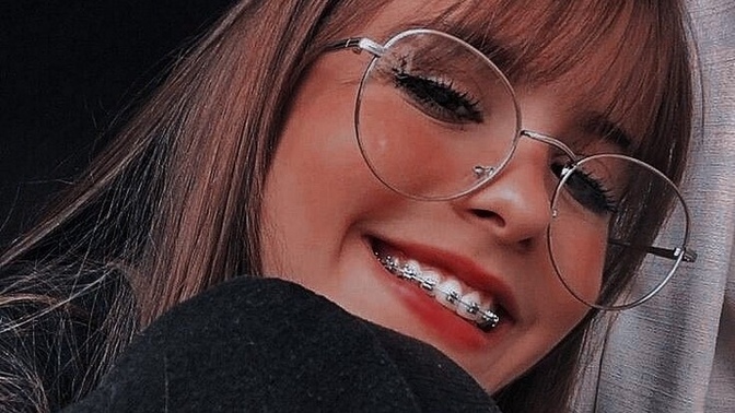 Diş teli taktırdınız mı ve taktırmak ister miydiniz?
