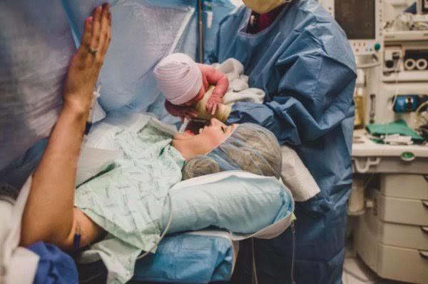 Sezeryan doğumda genel anestezi mi, yoksa epidural anestezi mi daha iyidir?