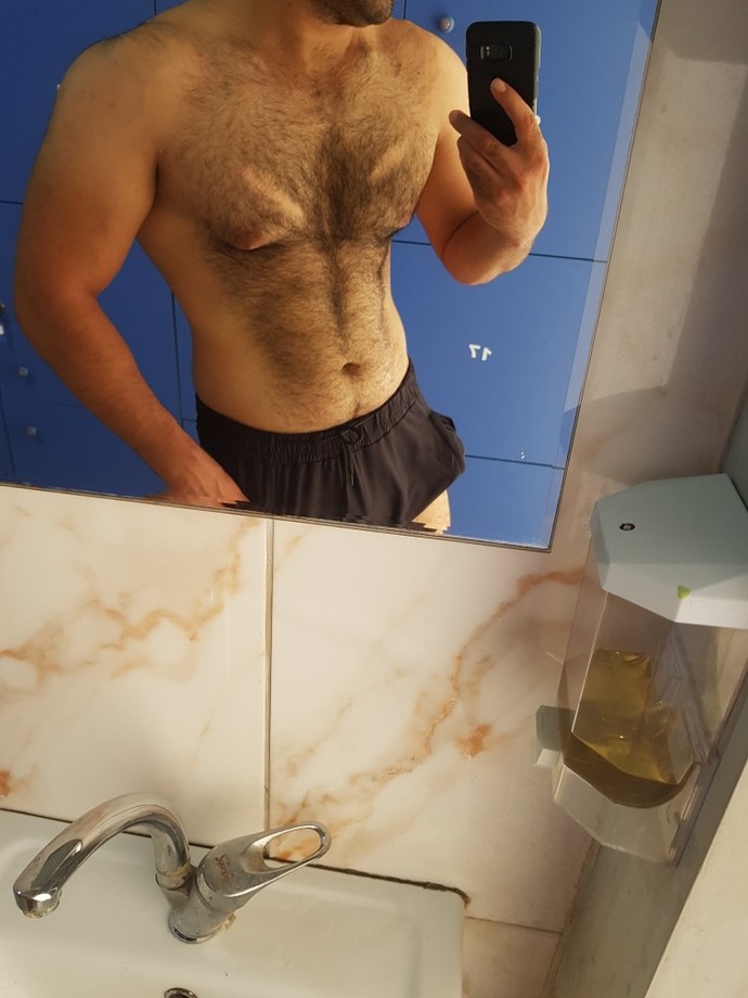 Yara izleriniz var mı?