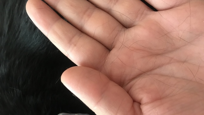 Parazit aşısı zamanı gelmiş kedi çok tüy döker mi?