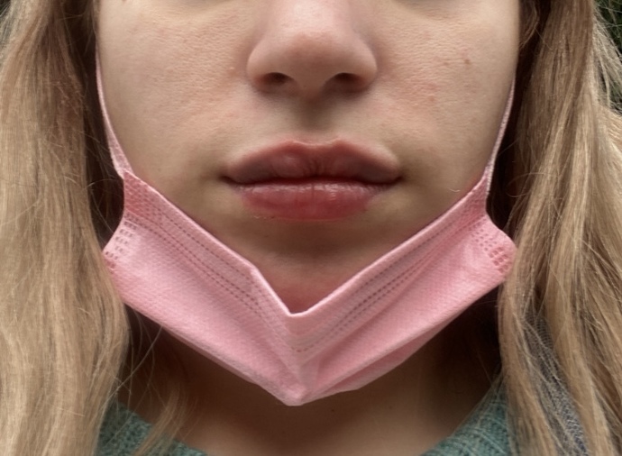 Dudaklarım nasıl olmuş?