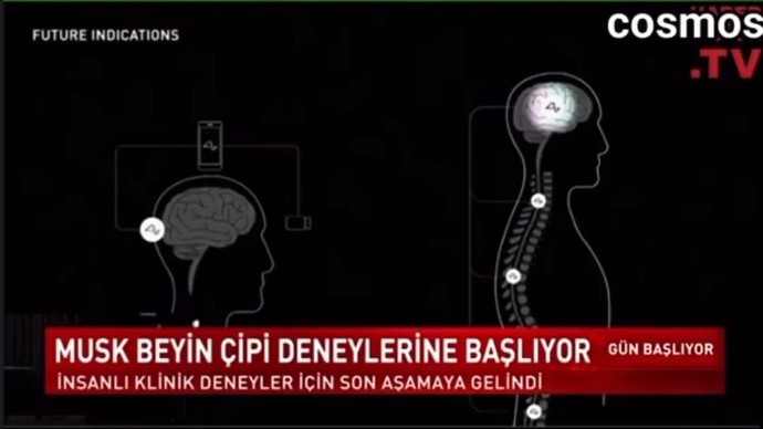 İnsanlı deneyler için son aşamaya gelindi! Siz kendinize çip takılmasına izin verir misiniz?