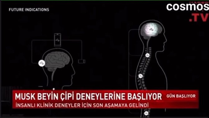 İnsanlı deneyler için son aşamaya gelindi! Siz kendinize çip takılmasına izin verir misiniz?