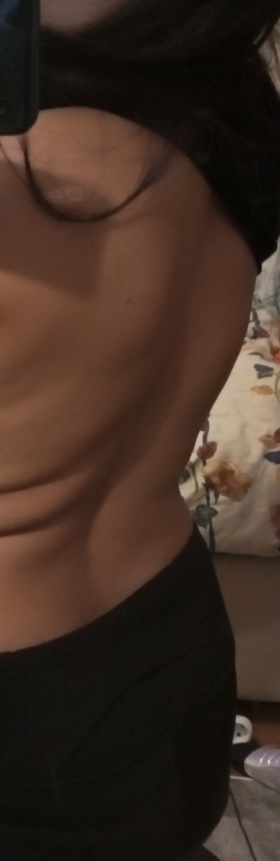 Sırtımda böyle bı şişlik var nedeni ne olabilir?