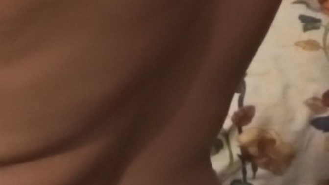 Sırtımda böyle bı şişlik var nedeni ne olabilir?