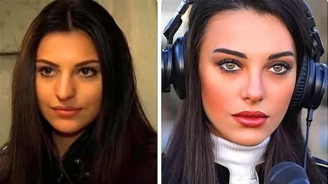 Burnum büyük diye bana laz mısın diye soruyorlar. Estetik mi olmak lazım?