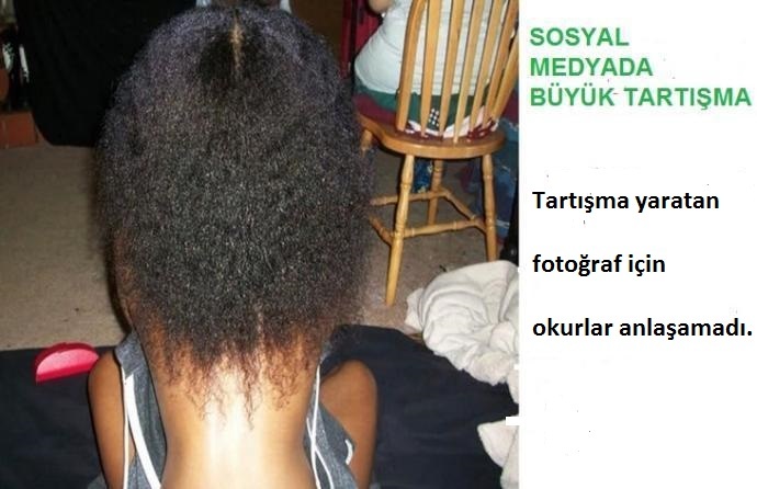 Bu fotoğraf tartışma yarattı! Sizce bel mi, boyun mu, ense mi, sırt mı?