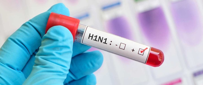 Influenza salgınına yakalanmış olanlar, kendinize ne çeşit bir tedavi uyguluyorsunuz?