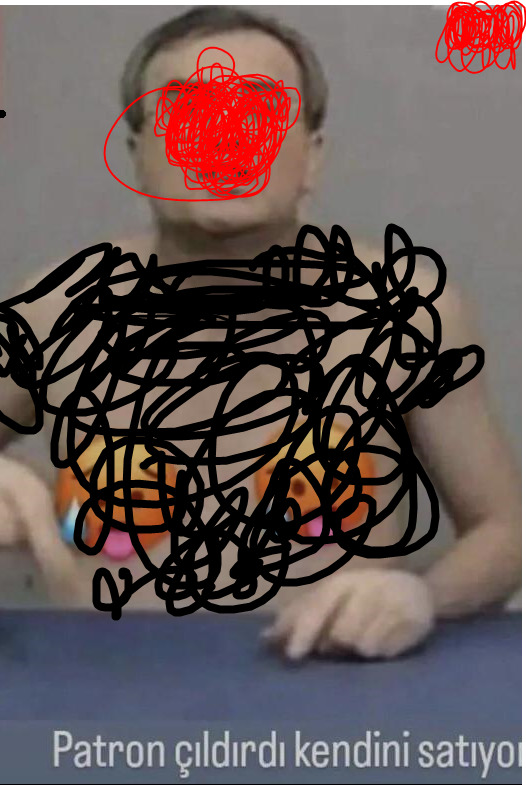 Anksiyete yüzünden kalp ilacına başladım sizdeki belirtiler neler anksiyetenin?