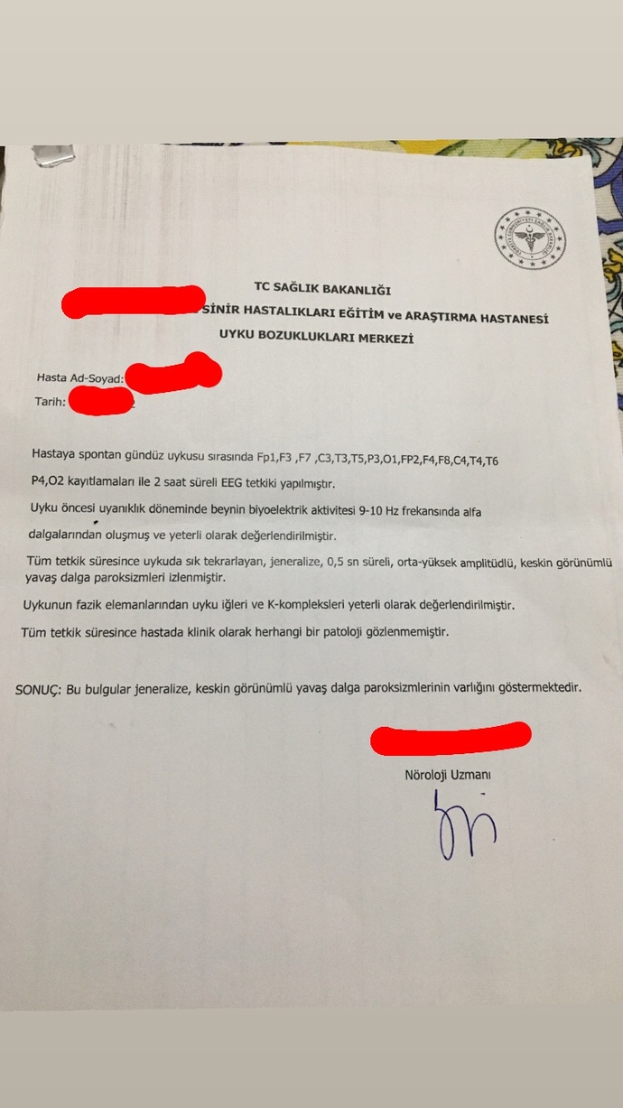 Uykuda EEG çekimi sonuçlarından anlayan var mı?