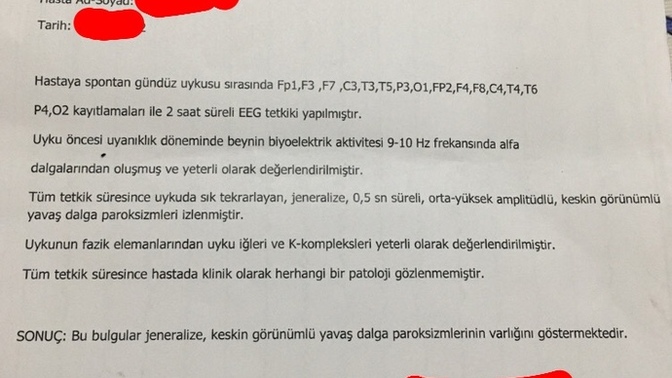 Uykuda EEG çekimi sonuçlarından anlayan var mı?