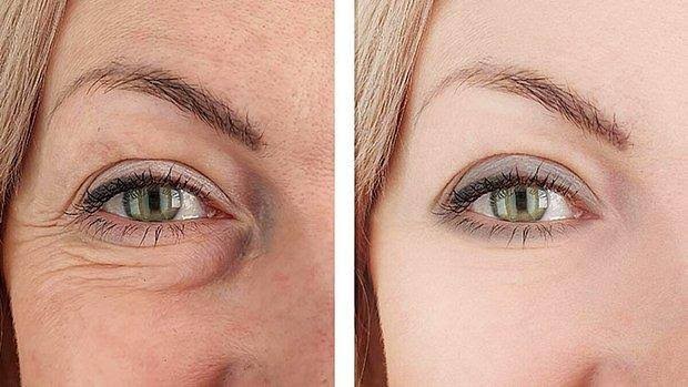 27 yaş kırışıklık karşıtı serum kullanmak için çok mu erken?