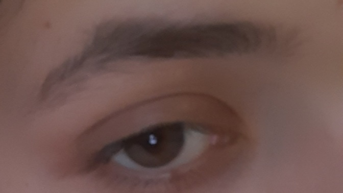 Göz kapaklarım ve kaşım düşük duruyor, bunun çaresi var mı?