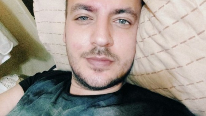 Saçlarda beyazlama olan var mı?