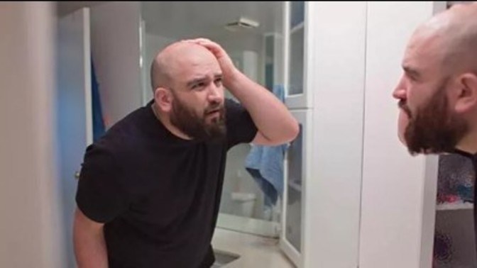 Saç dökülmesi erkekler için bir eksi mi?