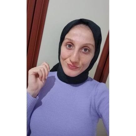 Göz rengim yeşil mi ela mı?