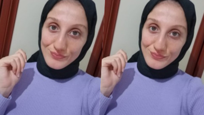 Göz rengim yeşil mi ela mı?