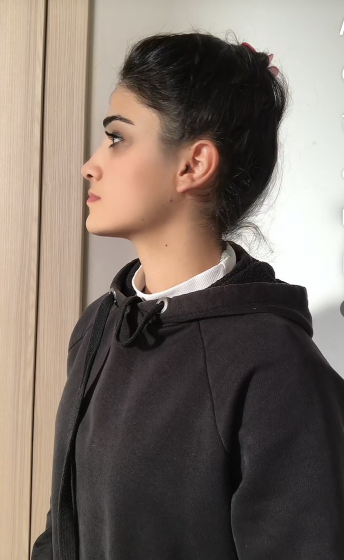 Burnum ve çene yapım nasıl duruyor, arkadaşım dalga geçiyordu sürekli😏?