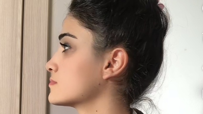 Burnum ve çene yapım nasıl duruyor, arkadaşım dalga geçiyordu sürekli😏?