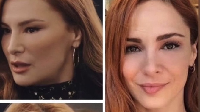 Mine Tugay, ip askısı yöntemiyle yüzünü gerdirmiş. Yeni halini beğendiniz mi?