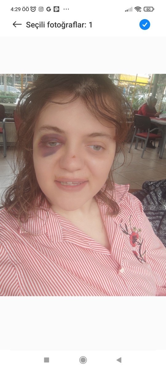 Arkadaşlar diğer hesabımdan buna geçtim biraz benimle ilgilenir misiniz Bana artık geri dönmez değil mi Birde ben çok mu çirkinim?