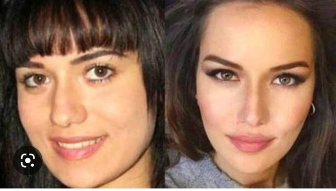 Burun estetiği bir insanı ne kadar değiştirebilir, gördüğünüzde vay be dediğiniz biri oldu mu?