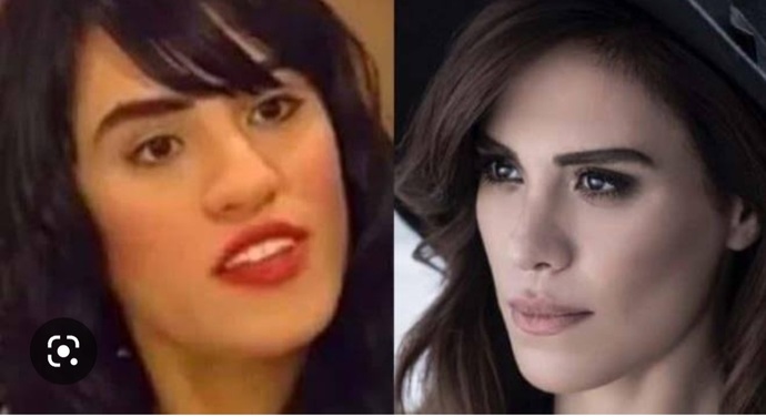 Burun estetiği bir insanı ne kadar değiştirebilir, gördüğünüzde vay be dediğiniz biri oldu mu?
