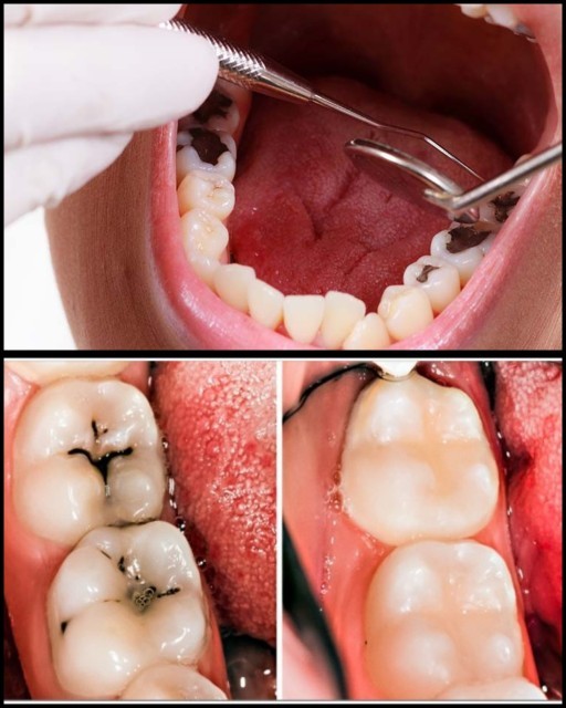 Dişçi korkunuz var mı? en son ne zaman dişçiye niçin gittiniz🦷ve diş ağrısı ne zaman yaşadınız?