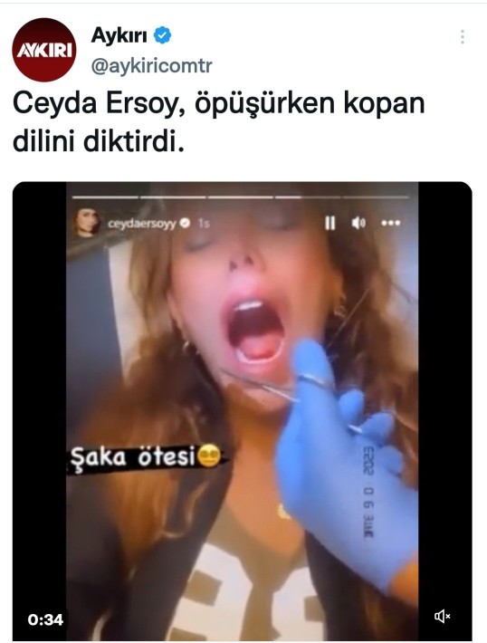Bu abla öpüşürken dilini koparmış. Sizce bu nasıl olabilir?
