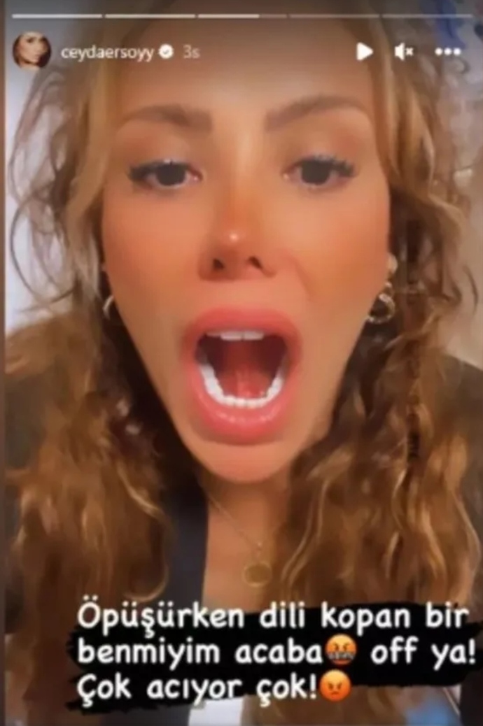 Ciciş Ceyda Ersoyun öpüşürken dili koptu! Bu konuda ne düşünüyorsunuz?