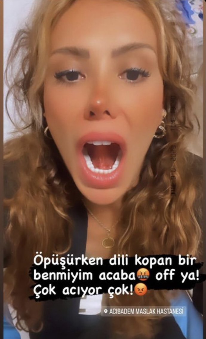 Ceyda Ersoyun öpüşürken dili koptu. Öpüşmeyi bilmeyen biriyle sevgili olur muydunuz?