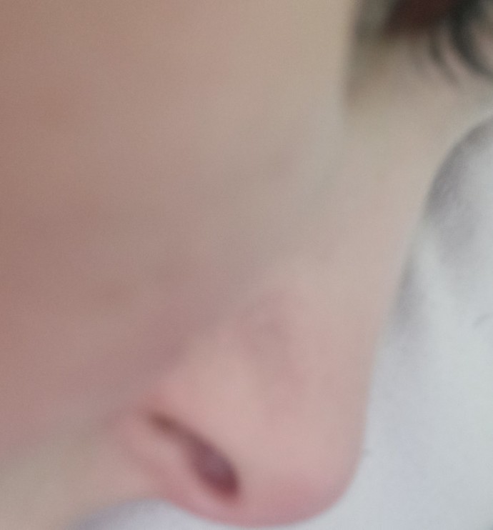 Burnumun estetiğe ihtiyacı var mı?
