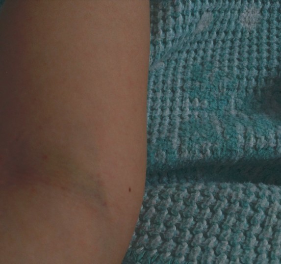 Sanırım evrim geçiriyorum! Nasıl düzelebilirim😱?