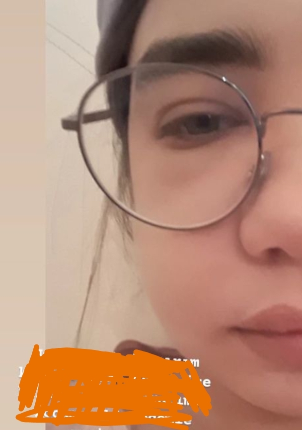 Gözüme kadar çıkan ödem gözüme zarar verir mi?