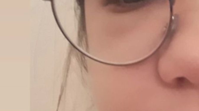 Gözüme kadar çıkan ödem gözüme zarar verir mi?