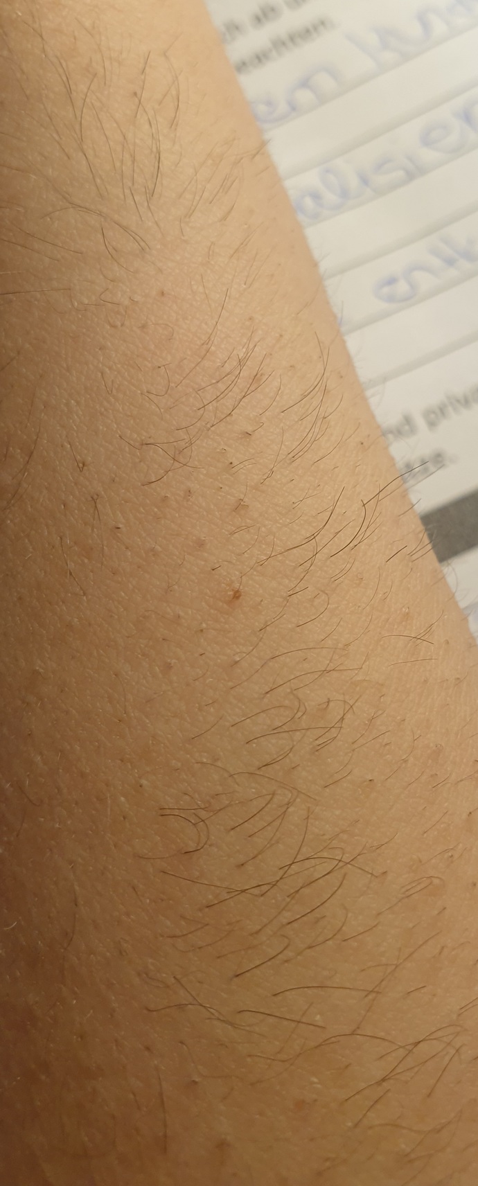 Lazer ile tecrubesi olanlar bakabilir mi 3 seans gittim ve hala böyle?
