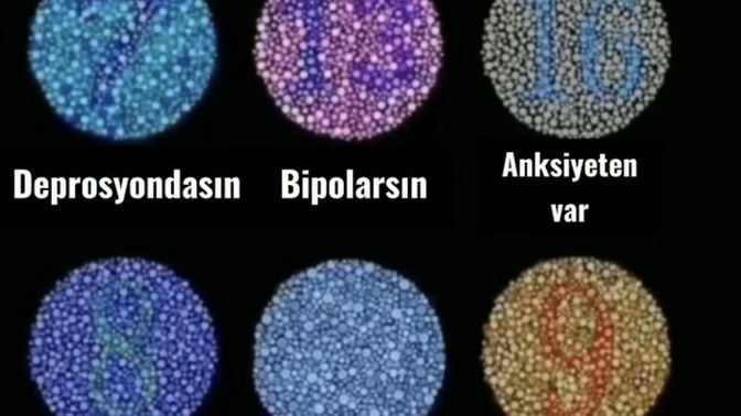 Aşağıdaki fotoğrafta sayısını göremediğiniz var mı?