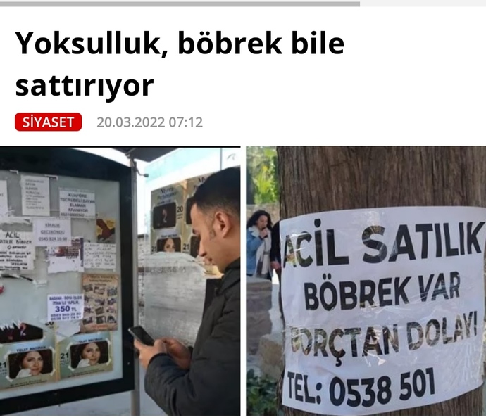 Parasızlıktan böbreğinizi satar mısınız?