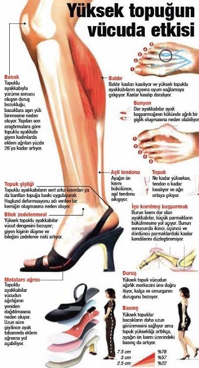 Ayaklarım çok ağrıyor. Topuklu ayakkabı vurmasına ne iyi gelir?
