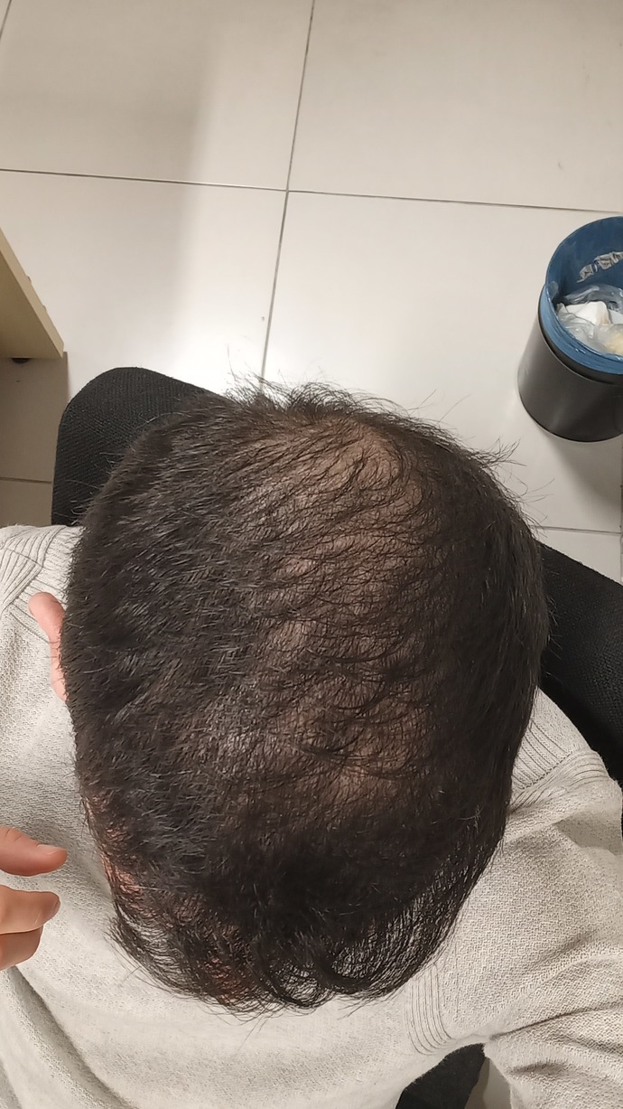 Sizce erkekte boyle bir saç bir kadina cok mu itici gelir. Yaşım 34 ?