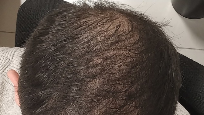 Sizce erkekte boyle bir saç bir kadina cok mu itici gelir. Yaşım 34 ?