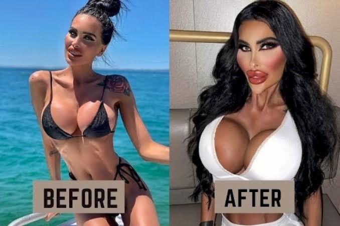Bir estetik yaptıran müptelası mı oluyor?