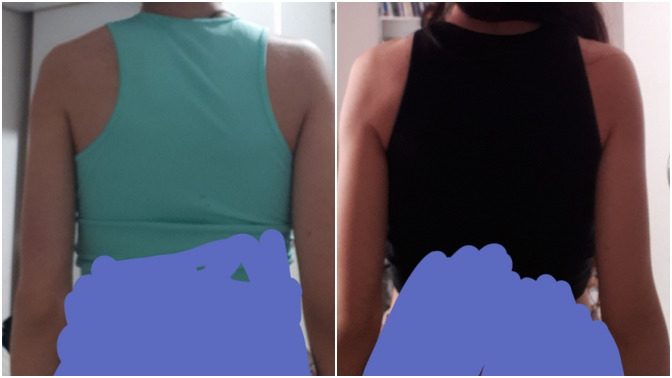 6 aydır fitness yapıyorum. Omuz bölgem gelişmeye başlamış mı?