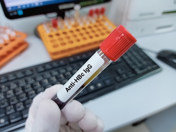 anti hbs negatif nedir?