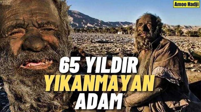 11 gündür duş almıyorum, sağlığıma zararı olur mu?