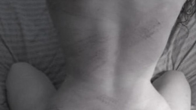 Seks yaparken partnerinin vücudunda iz bırakmak övünülecek bir şey midir?